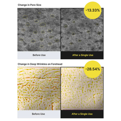CELIMAX Vita-A Retinal Shot Tightening Booster 15ml