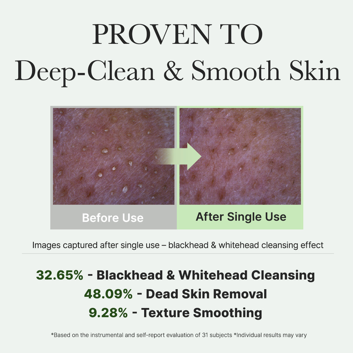 Arencia Fresh Green Rice Mochi Cleanser, Gentle Daily Cleanser for Acne-Prone Skin