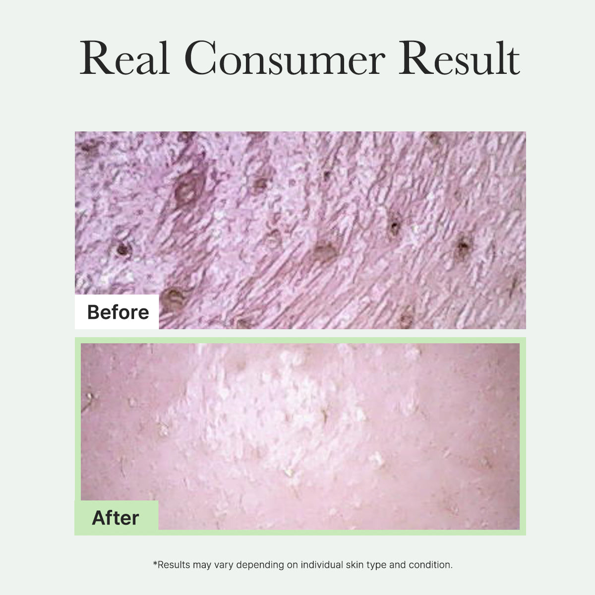 Arencia Fresh Green Rice Mochi Cleanser, Gentle Daily Cleanser for Acne-Prone Skin