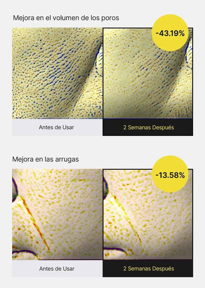 CELIMAX The Vita A Retinol Shot Tightening Serum 30ml – Wrinkle Care, Pore Tightening & Firm Skin | Korean Skincare - Amora Skin