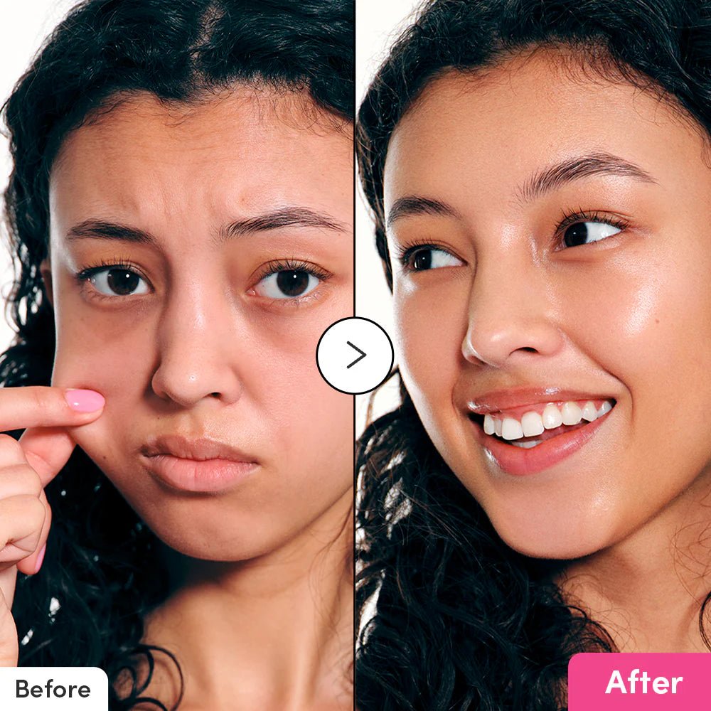 Eqqualberry NAD+ Peptide Boosting Serum 30ml – Anti - Aging, Firming & Collagen Boost | Korean Skincare - Amora Skin