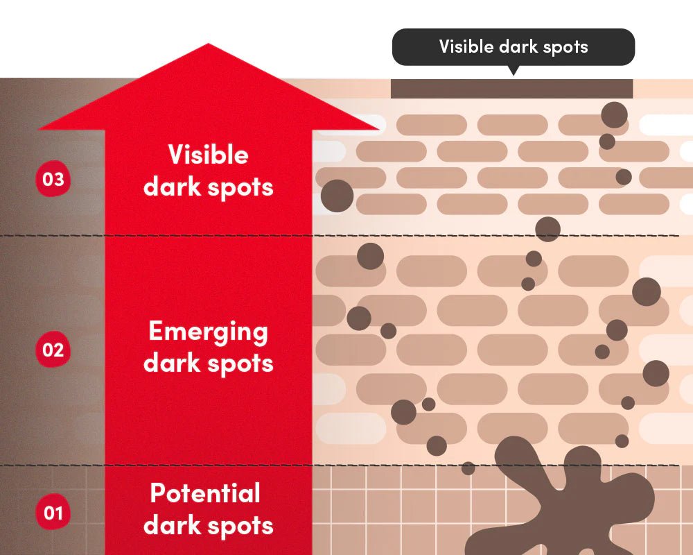 Eqqualberry Vitamin Illuminating Serum – Dark Spot Correcting & Brightening Serum | Brightening & Tone Correcting Skincare - Amora Skin