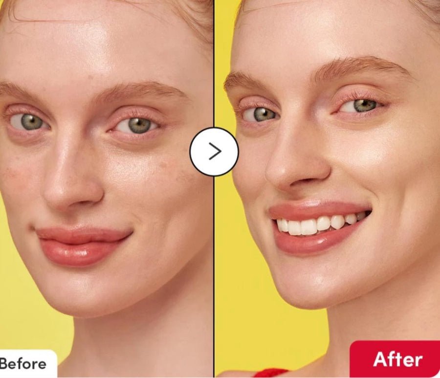 Eqqualberry Vitamin Illuminating Serum – Dark Spot Correcting & Brightening Serum | Brightening & Tone Correcting Skincare - Amora Skin