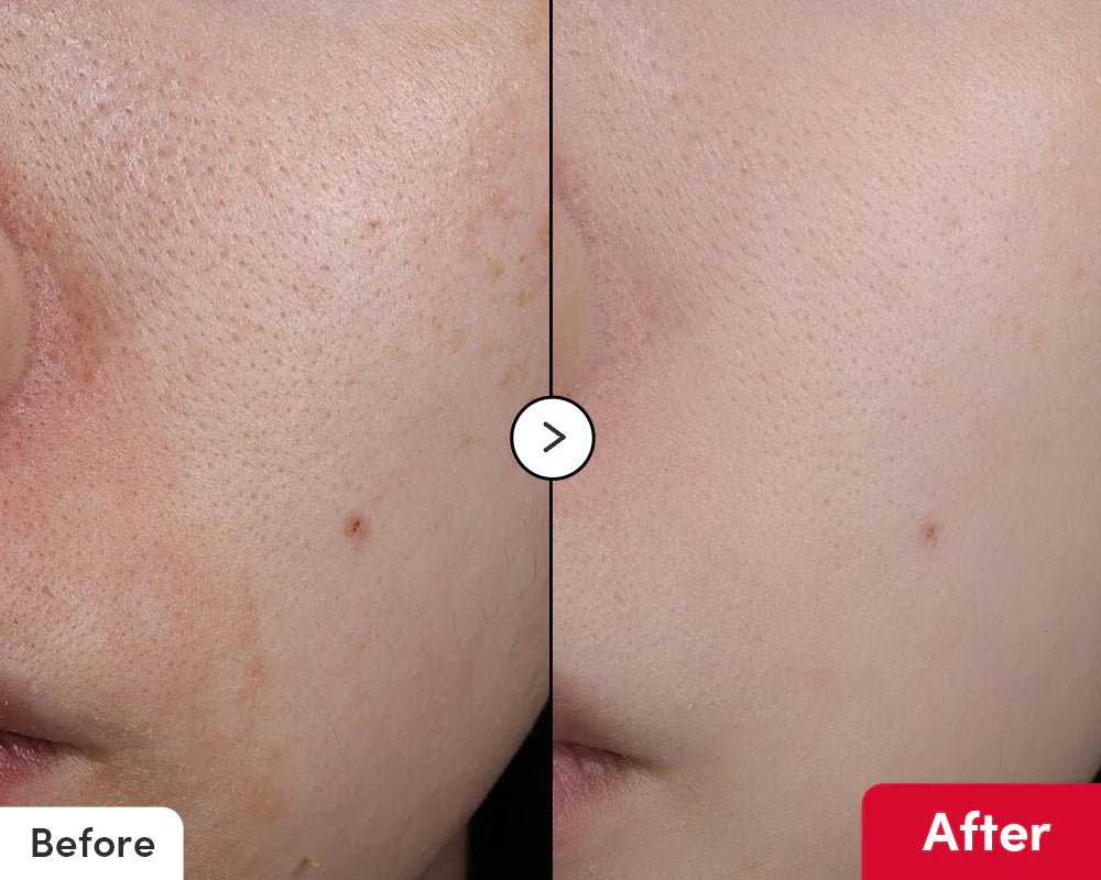 Eqqualberry Vitamin Illuminating Serum – Dark Spot Correcting & Brightening Serum | Brightening & Tone Correcting Skincare - Amora Skin