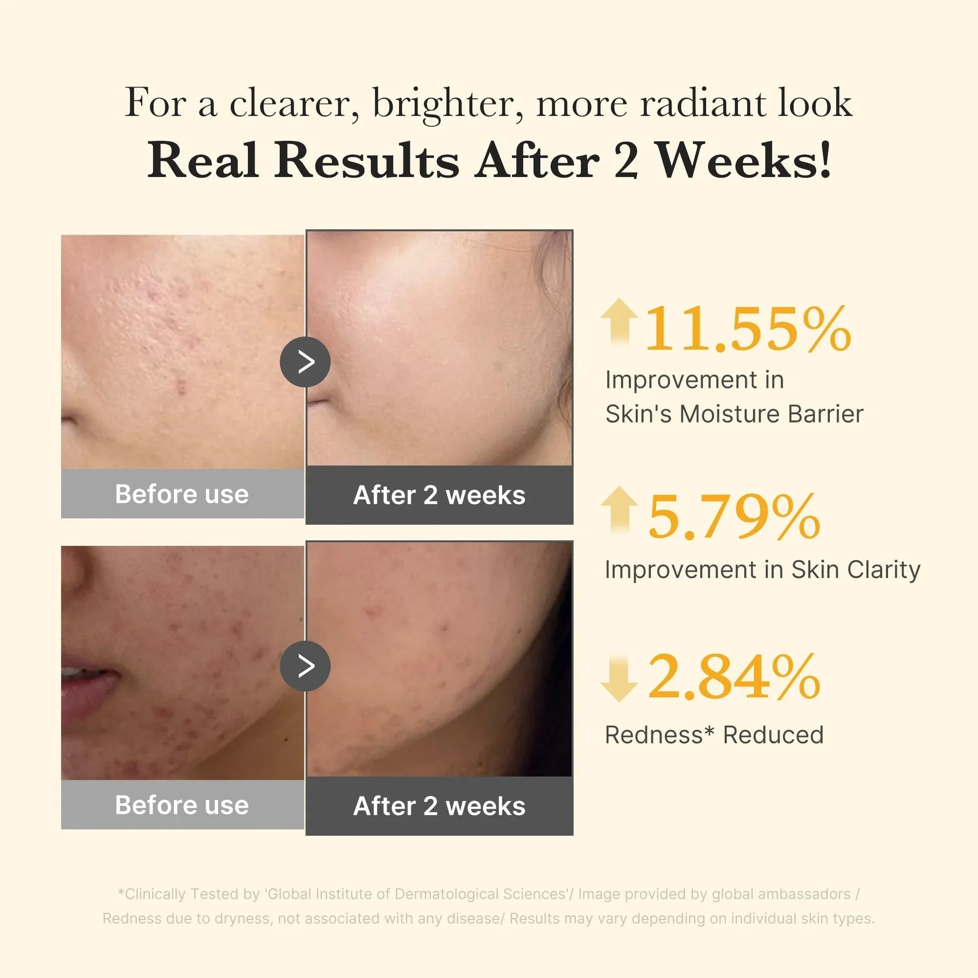 MEDICUBE Kojic Acid Turmeric Capsule Serum – Brightening & Tone - Correcting Serum for Dark Spots, Uneven Skin & Radiant Glow | Korean Skincare - Amora Skin