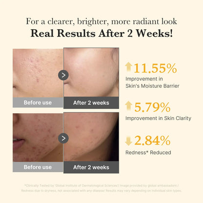 MEDICUBE Kojic Acid Turmeric Capsule Serum – Brightening & Tone - Correcting Serum for Dark Spots, Uneven Skin & Radiant Glow | Korean Skincare - Amora Skin