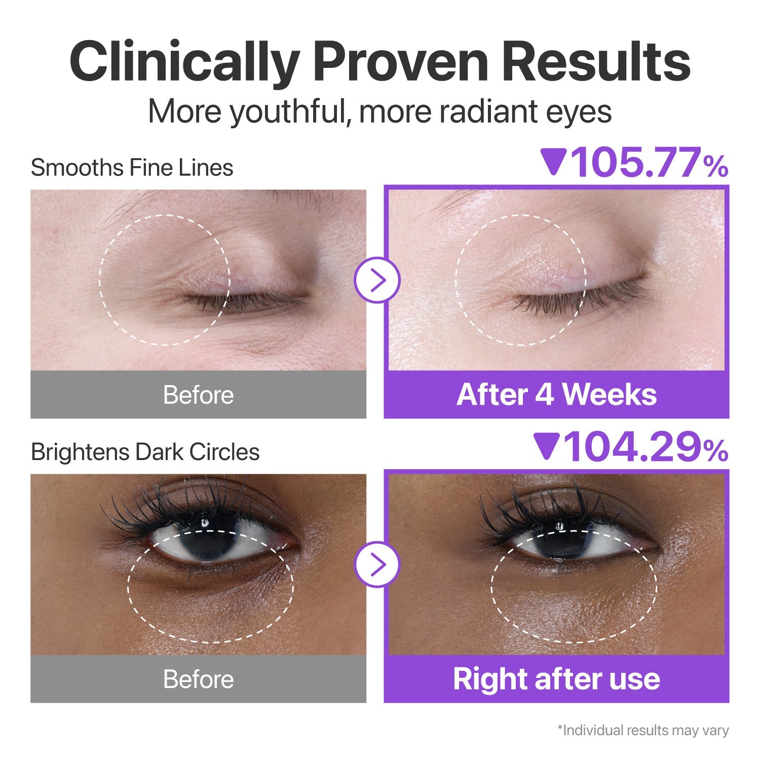 Numbuzin No.9 NAD+ Retinol Volumetox Eye Cream – Firming, Brightening & Anti - Aging Eye Treatment - Amora Skin